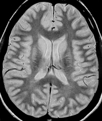 Les techniques utilisées 1 neuro1 2