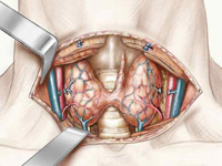 Schéma représentant l'anatomie de la thyroïde (vue antérieure de la thyroïde)