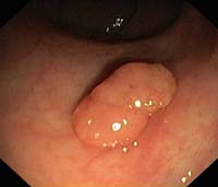 Gastroentérologie 1 OLYM0004b