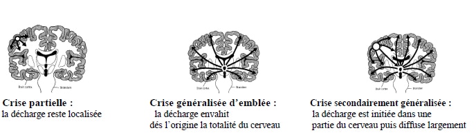 neuro1 1