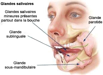 Cancer glandes salivaires - Inflammation des glandes salivaires ...