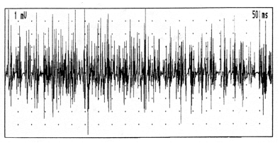 electromyogramme2