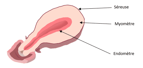 Cancer de l'endomètre 1 image 1