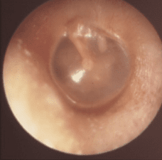 anatomie oreille2