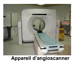 angioscanner2